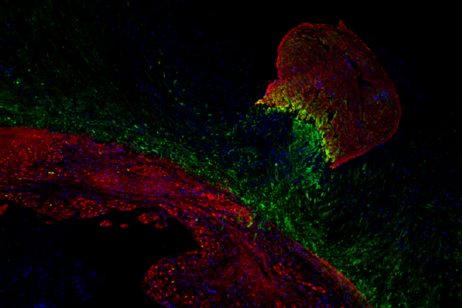 In verde la proteina Hmga1 nel cuore di un pesce zebra (in alto a destra), in rosso le cellule del muscolo cardiaco, in blu il nucleo cellulare: Dennis de Bakker e Ward Groutars/ Hubrecht Institute)