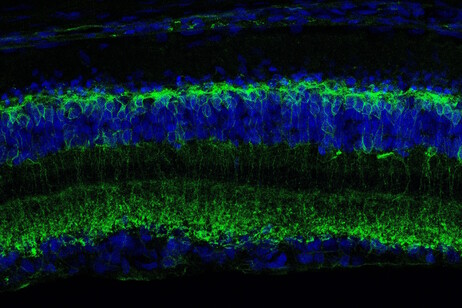 Sezione trasversale di una retina degenerata vista al microscopio confocale. In verde le cellule attivate dalla molecola Ziapin2 (fonte:  Istituto Italiano di Tecnologia - IIT)