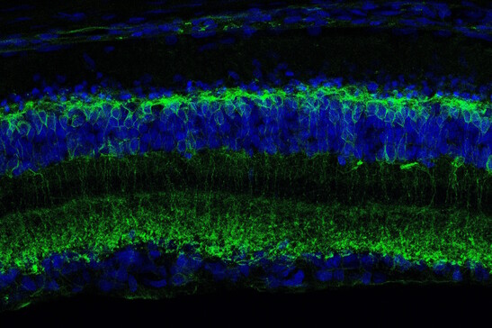 Sezione trasversale di una retina degenerata vista al microscopio confocale. In verde le cellule attivate dalla molecola Ziapin2 (fonte:  Istituto Italiano di Tecnologia - IIT)