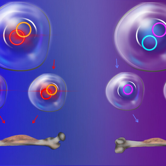 Gli ecDna che si appaiano&nbsp;tendono ad essere ereditati insieme e promuovono più facilmente la crescita delle cellule tumorali (fonte:&nbsp;Emily Moskal/Stanford Medicine)